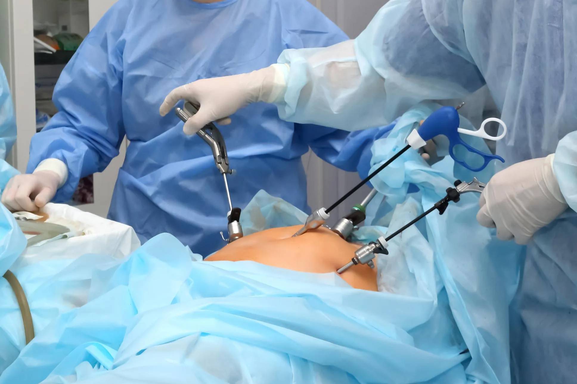 Laparoscopic Surgery
