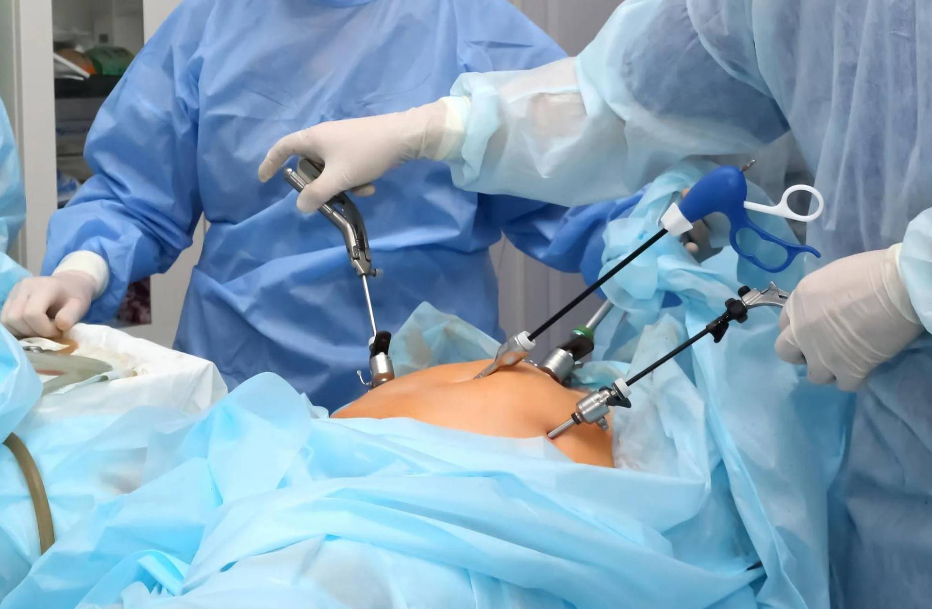 Laparoscopic